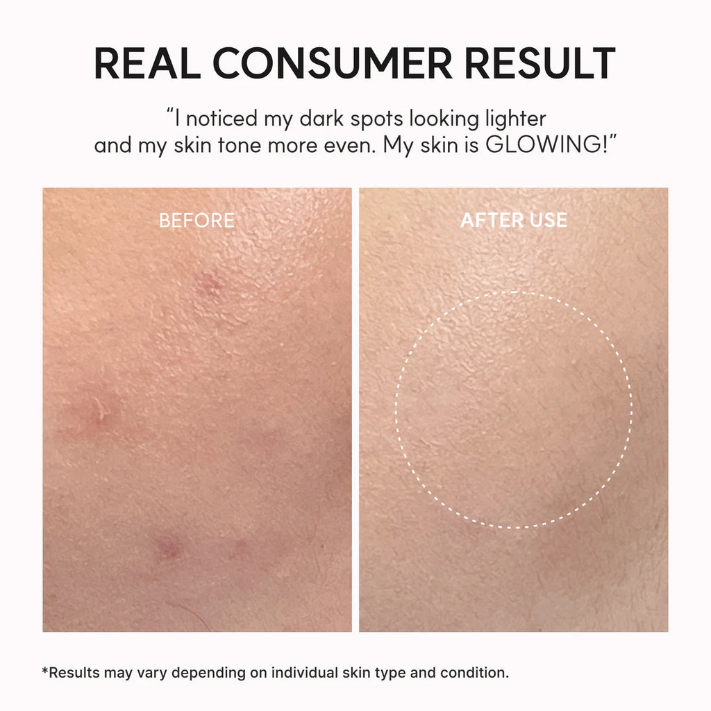 TXA Booster Shot, Intensive Dark Spot Correcting Serum